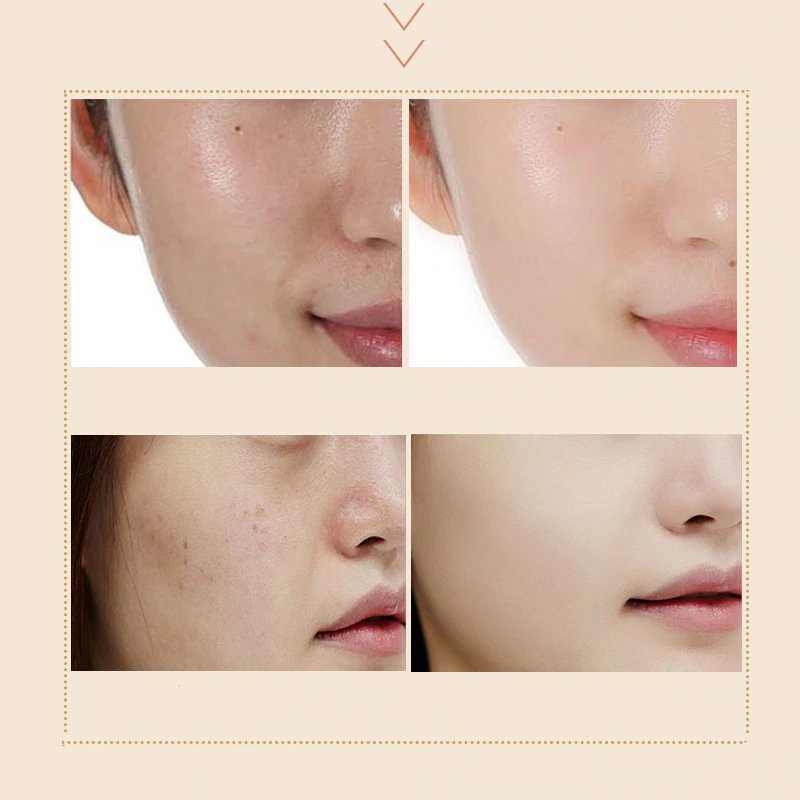 Anti Aging Snail Essence Facial Cream